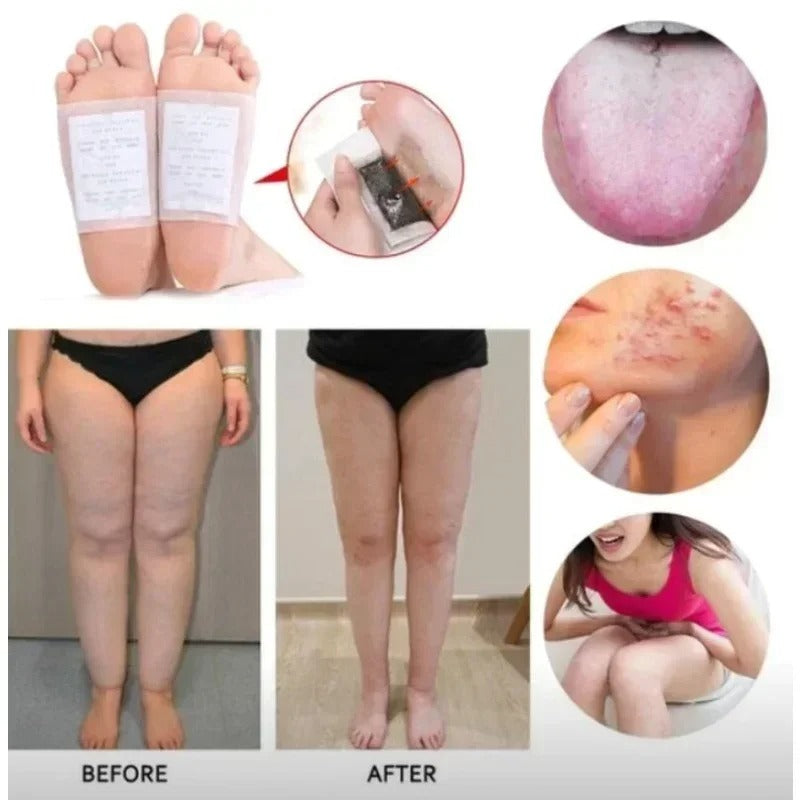 Kinoki Original Detox Foot Patch