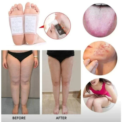 Kinoki Original Detox Foot Patch