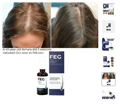Hair Growth Spray | بخاخ نمو الشعر