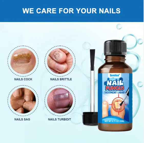 Sumifun – Nail Fungus Treatment Liquid سائل سوميفن لعلاج فطريات الأظافر